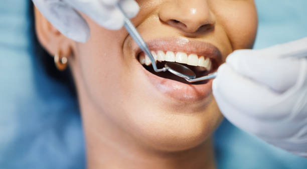 Best Emergency Dental Care for Sports Injuries in Tyndall, SD